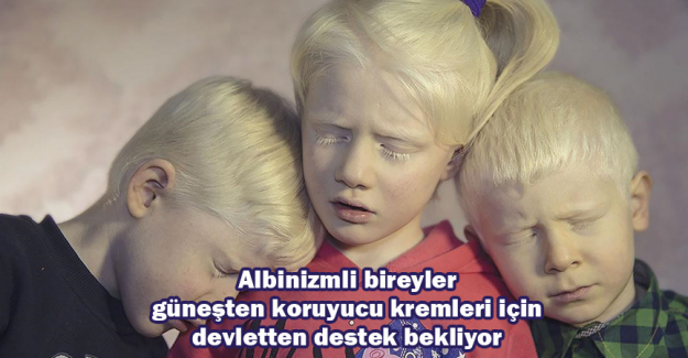 Albinizmli bireyler g&uuml;neşten koruyucu kremleri i&ccedil;in devletten destek bekliyor