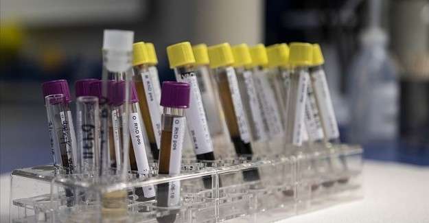 Birleşik Krallık'ta 'gizemli hepatit' vir&uuml;s&uuml; bulaşan 8 &ccedil;ocuğa karaciğer nakli yapıldı