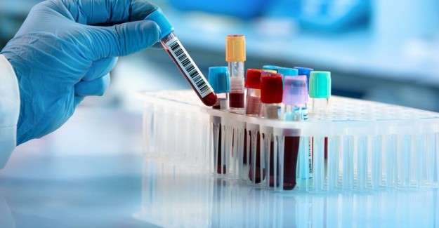 İngiltere&rsquo;den yayılan gizemli hepatit vir&uuml;s&uuml;, k&uuml;resel salgın ş&uuml;phesi uyandırıyor