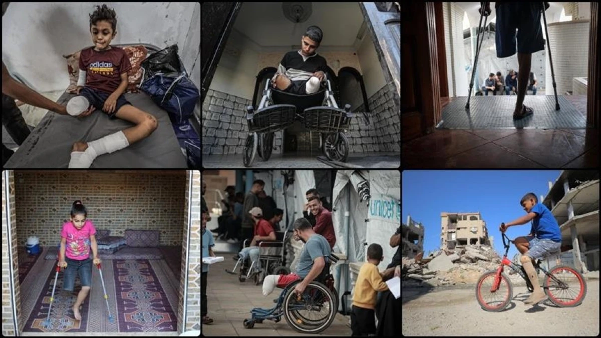 6,000 amputees need urgent long-term rehabilitation in Gaza, Health Ministry says